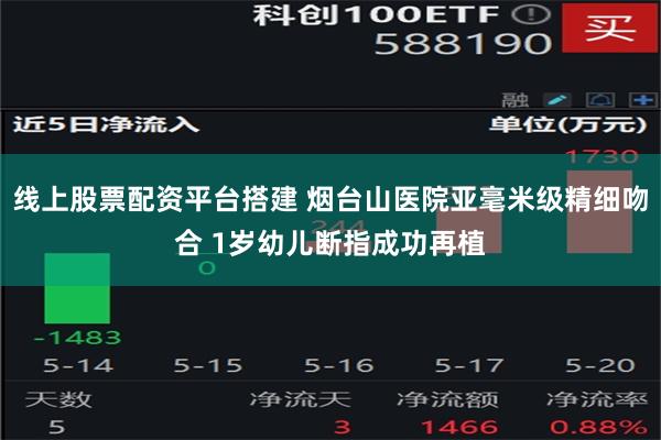 线上股票配资平台搭建 烟台山医院亚毫米级精细吻合 1岁幼儿断指成功再植